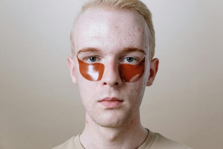 Man with eyepatch and acne
